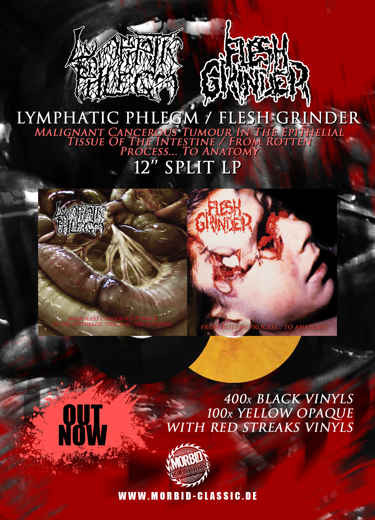 Lymphatic PHLEGM Fleshgrinder Split Vinyl LP