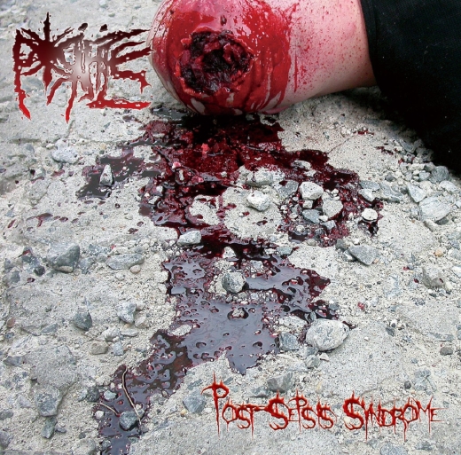 PORIFICE - Post Sepsis Syndrome CD