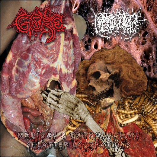 GORE/HIPERMENORREA - Medical & Pathological Splatter Lacerations EP (red)