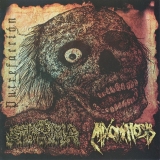 STOMA/MIXOMATOSIS - Split CD