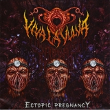 VIVA LA VULVA - Ectopic Pregnancy CD