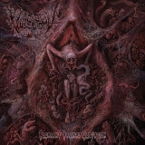 VULVECTOMY - Aberrant Vaginal Gestation LP (Splatter)