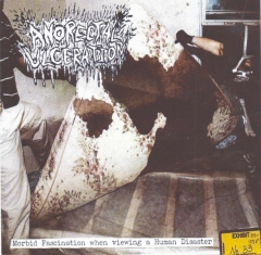 ANORECTAL ULCERATION - Morbid Fascination When Viewing A Human Disaster CD