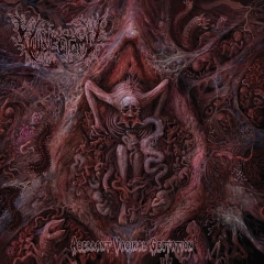 VULVECTOMY - Aberrant Vaginal Gestation LP