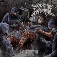 IMPENDING ANNIHILATION - Idiopathic Osteonecrosis of the Femoral Head MCD