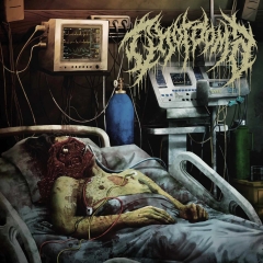 CHORDOMA - Chordoma MCD